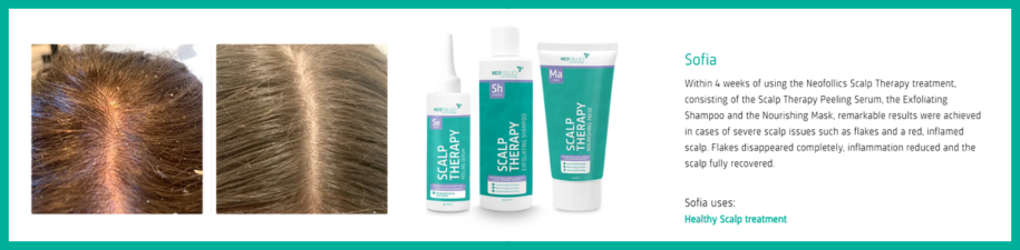 Neofollics - Scalp Therapy